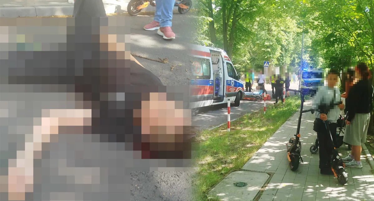 Wypadki drogowe, Groźny upadek hulajnogi Uderzył głową asfalt pojawiło dużo - zdjęcie, fotografia