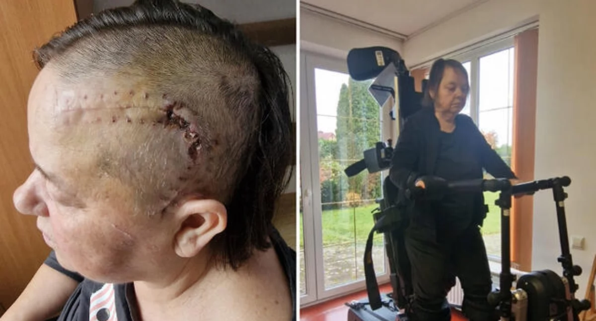 Akcje charytatywne, Rodzina Haliny Mazur dziękuje dotychczasową pomoc! - zdjęcie, fotografia
