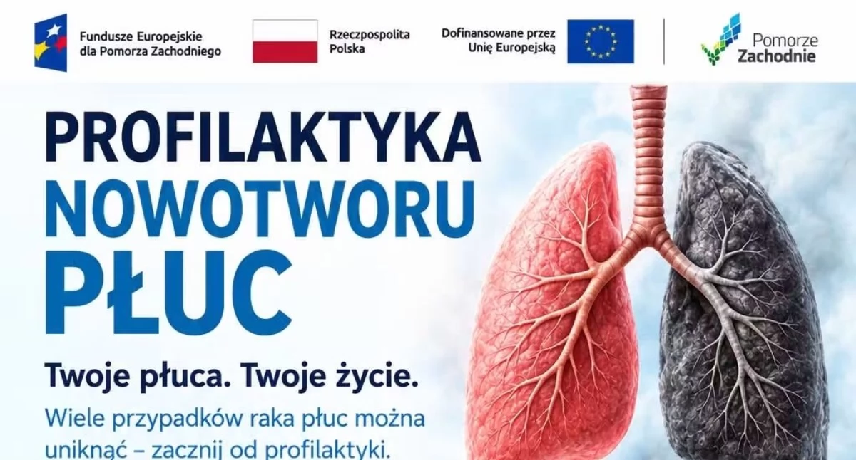 Zdrowie, Burmistrz Sawaryn zaprasza Zadbaj swoje zdrowie zbadaj płuca! - zdjęcie, fotografia
